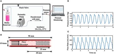 Design and Verification of a Novel Perfusion Bioreactor to Evaluate the Performance of a Self-Expanding Stent for Peripheral Artery Applications